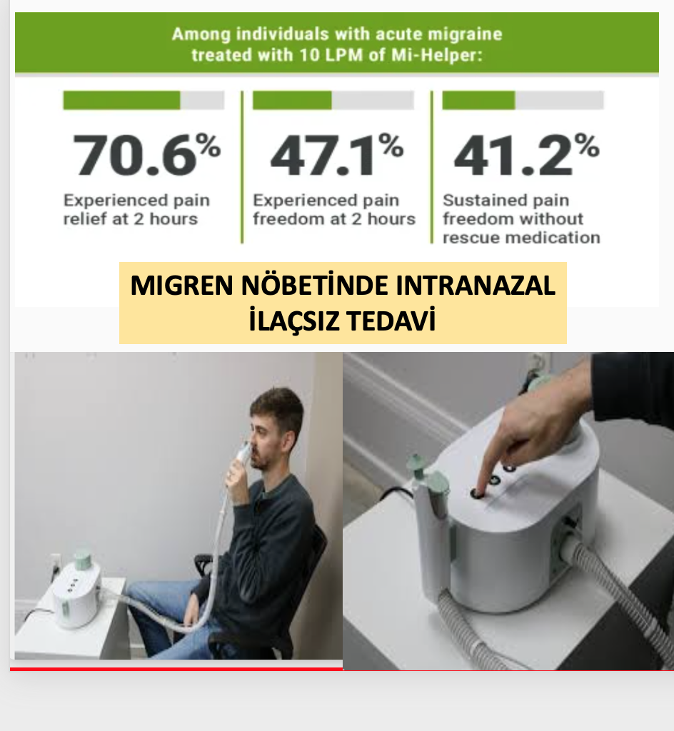 MİGREN NÖBETİNDE İLAÇSIZ TEDAVİ